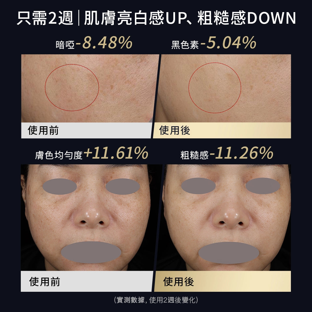 YA-MAN 綠光面罩 LED 美白光子嫩膚儀 YJMFOLCP 圖 3
